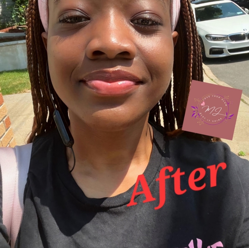 Exfoliator - Picture 4 of 8
